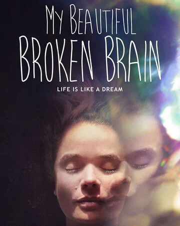 Khối óc xinh đẹp tội nghiệp của tôi My Beautiful Broken Brain